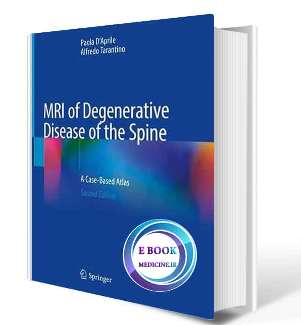 دانلود کتابMRI of Degenerative Disease of the Spine: A Case-Based Atlas 2nd ed. 2021 (ORIGINAL PDF)